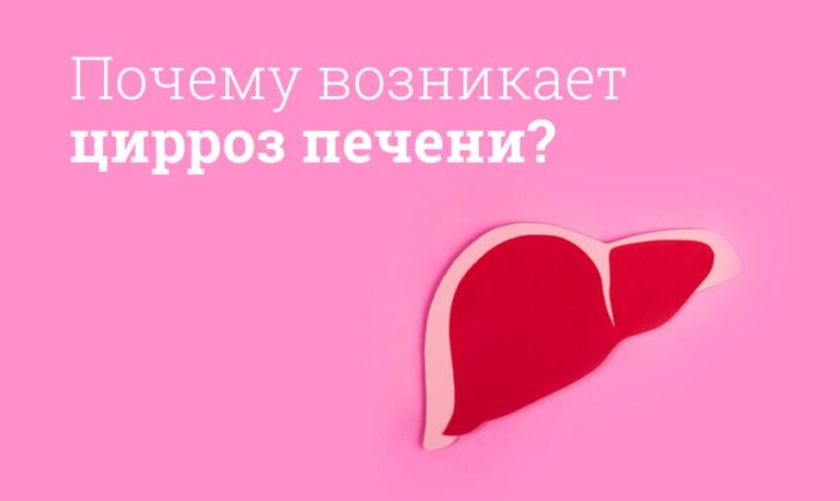 Цирроз печени симптомы и лечение у женщин и мужчин: Клинические рекомендации